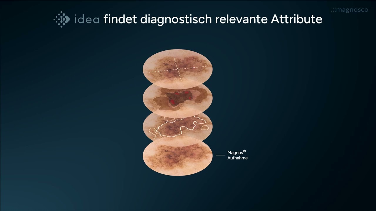 Transparente, interaktive KI für die Dermatologie