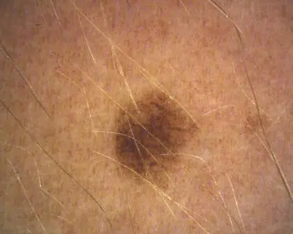 spot-cross-polarised