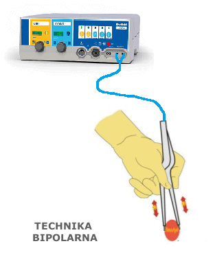 Technika Bipolarna Rysunek Bechtold technika-bipolarna-rysunek-bechtold