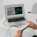 Dermus USG - obrazek 3