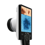 Wideodermatoskop Canfield D2